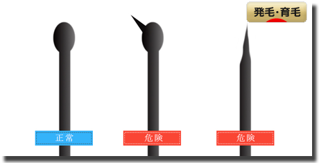 抜け毛の本数も大事ですが毛根の状態を気にしなければいけない ミノキシジルとプロペシアで育毛 育毛ニュース