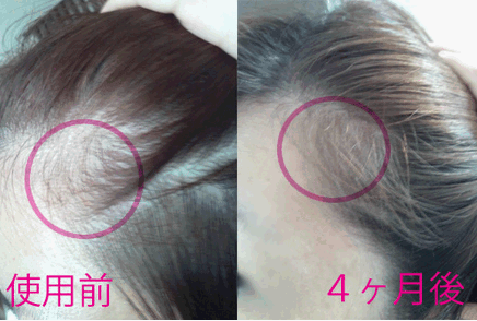敏感肌 乾燥肌の人向け 髪が細くなったらマイナチュレがいい ３０歳を超えた女性の髪質は悪化する現実を改善する方法