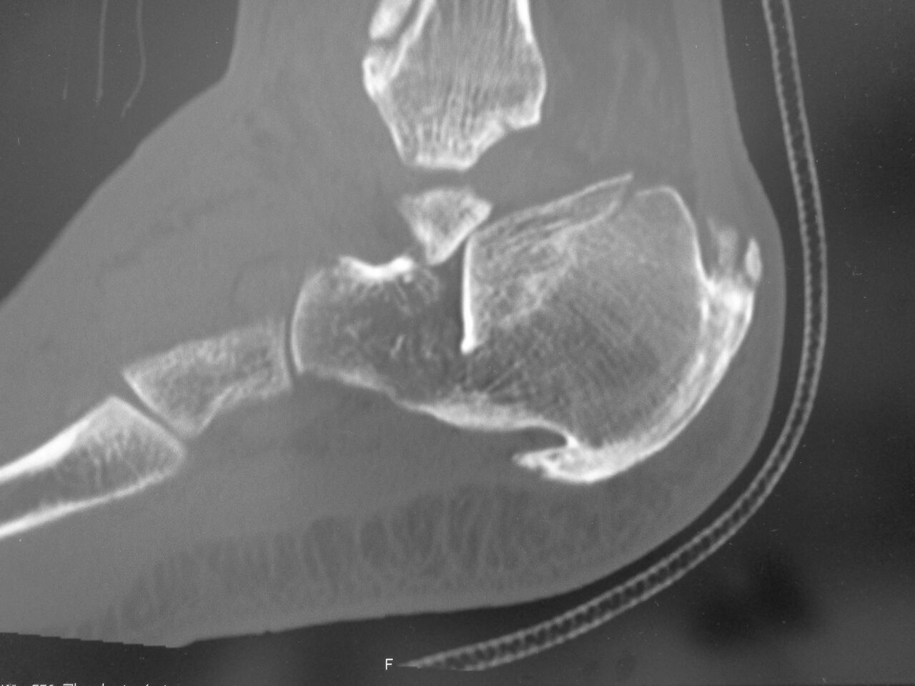 50代整形外科医の手術記録