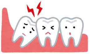 【画像】美人女性が親知らずを抜いた結果ｗｗｗｗ