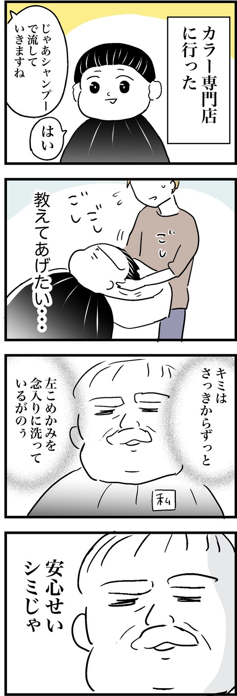 シミ 3