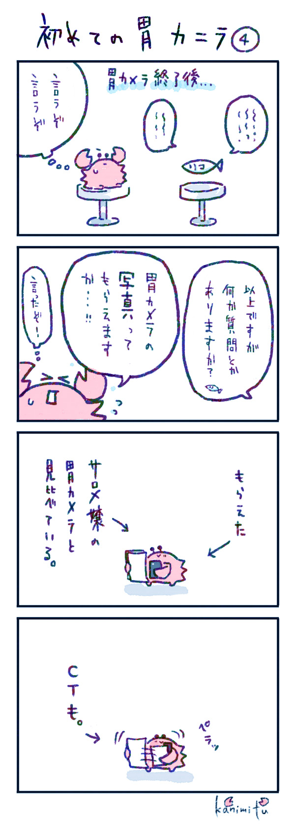 2025.06.30初めての胃カメラ4