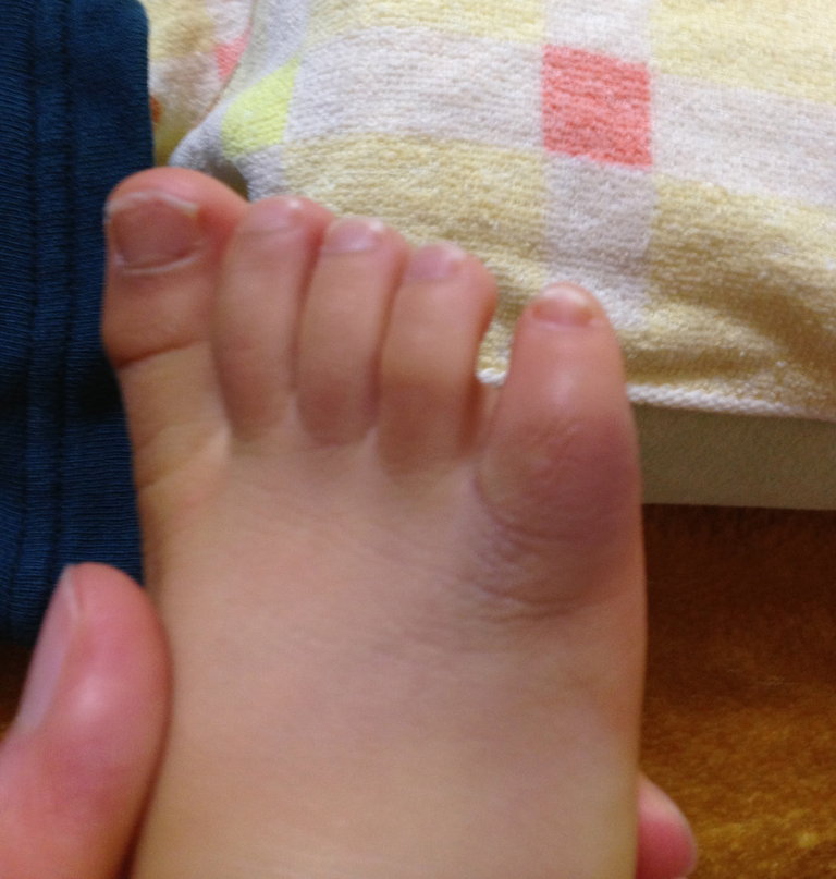 しもやけだった 薫風 かおるかぜ しもやけだった 薫風 かおるかぜ