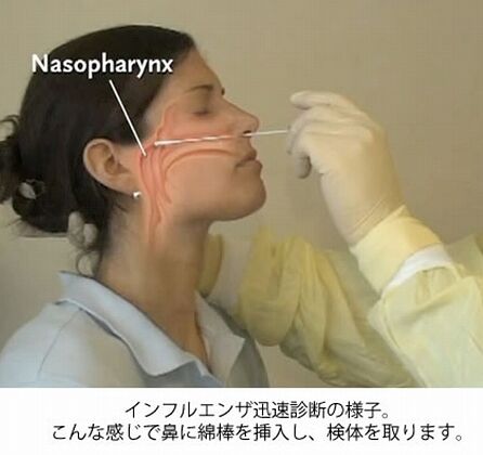 インフルエンザの綿棒位置