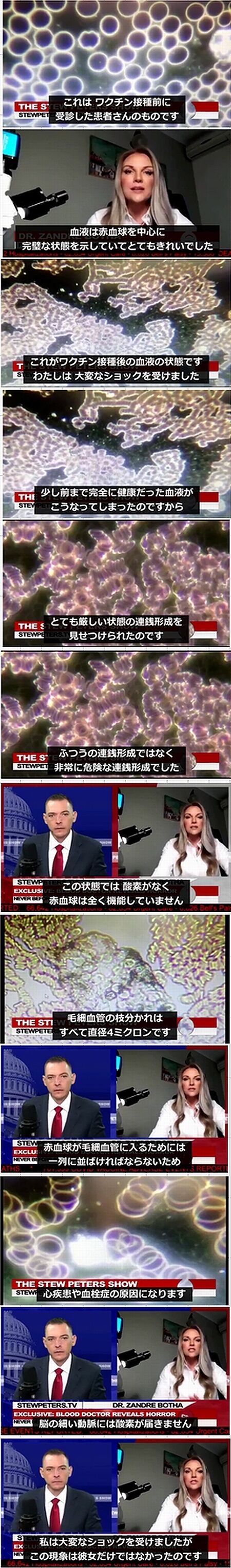 ワクチン接種で赤血球が異常化1