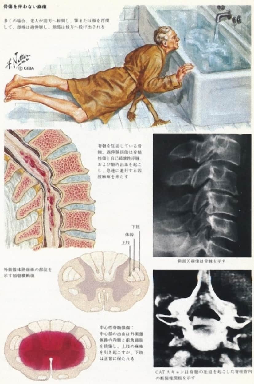 medical10_e