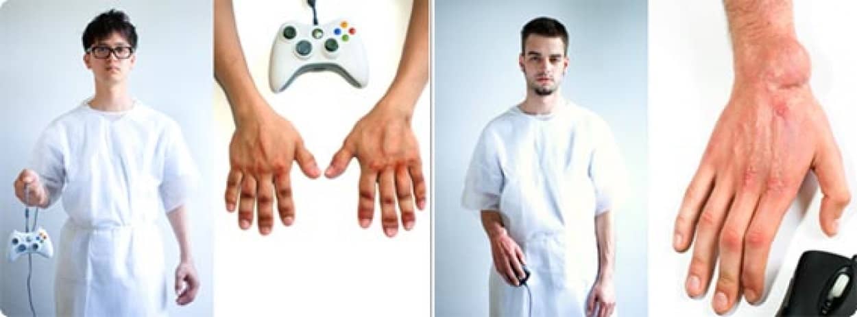 ゲームを長期間やりすぎると人間の体はどのように変化していくのか Game Arthritis カラパイア