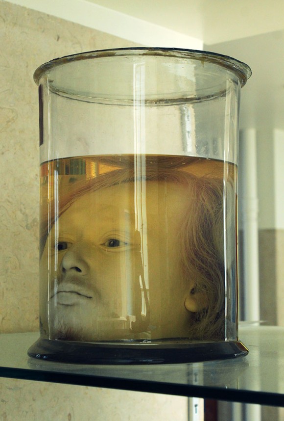 ホルマリン漬けにされ180年以上もの間 解剖学資料として展示されているポルトガルの連続殺人犯 カラパイア