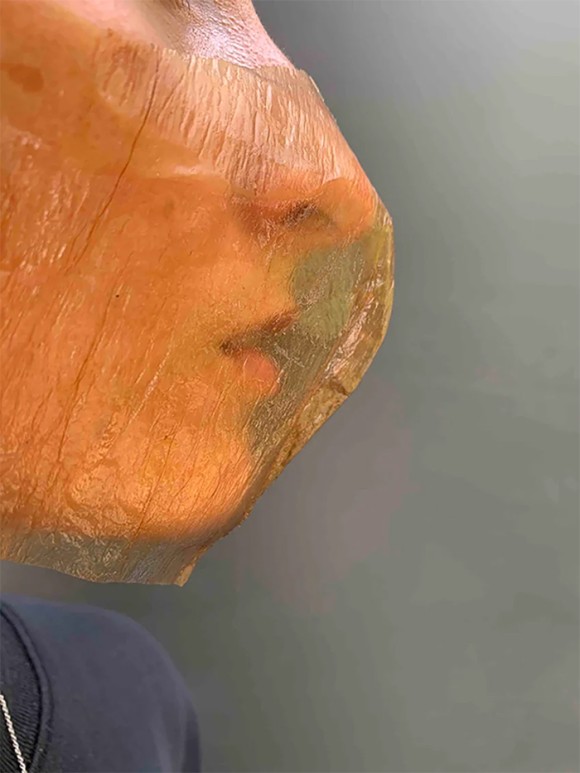 5_e1