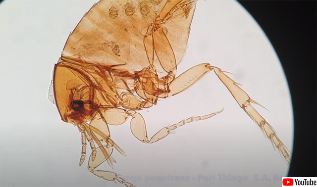 人間の皮膚の中に入り込んで卵をうみ 恐ろしい感染症を引き起こす寄生虫 スナノミ カラパイア