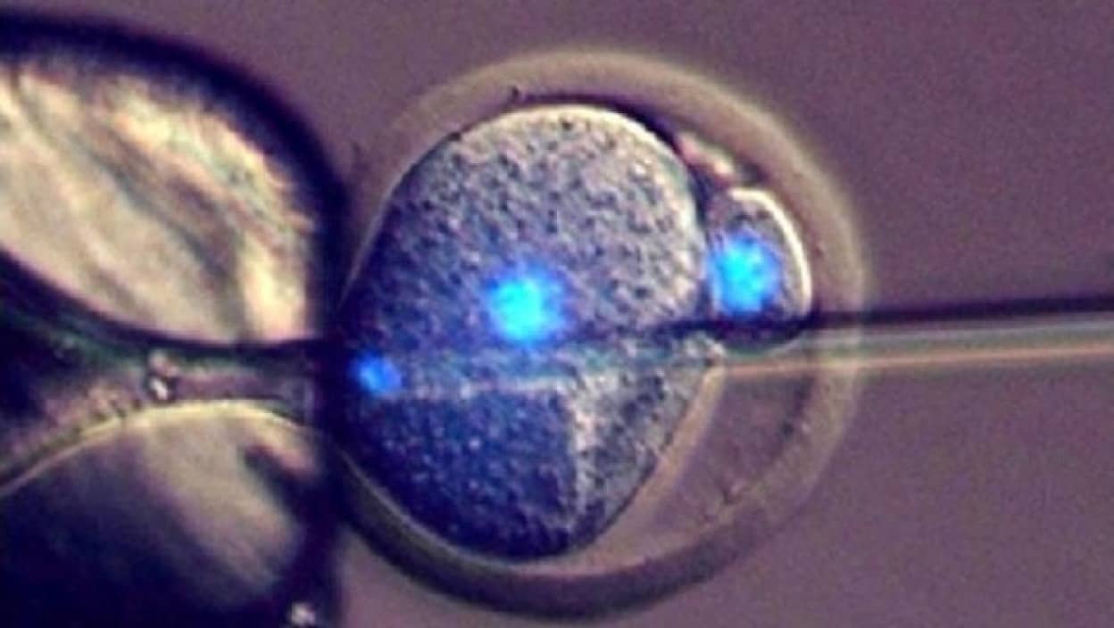 3_e1
