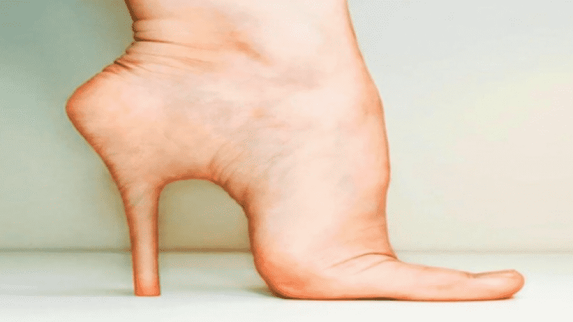 5_e1