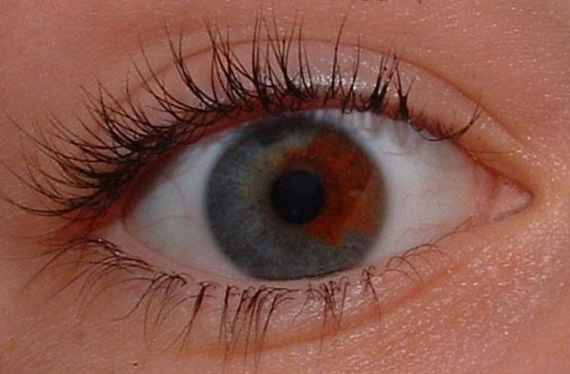美しいオッドアイを持つ人々の画像 The Beauty Of Multi Colored Eyes カラパイア