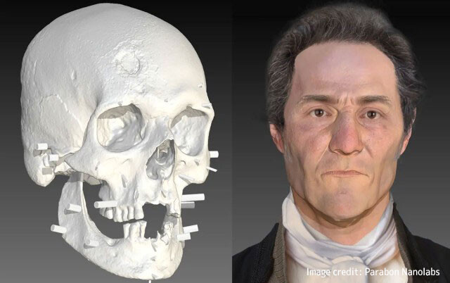 吸血鬼として埋葬されていた18世紀の男性の顔の復元に成功