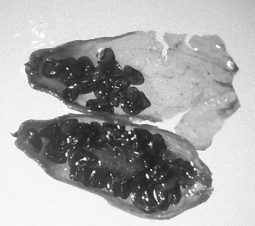 4_e1