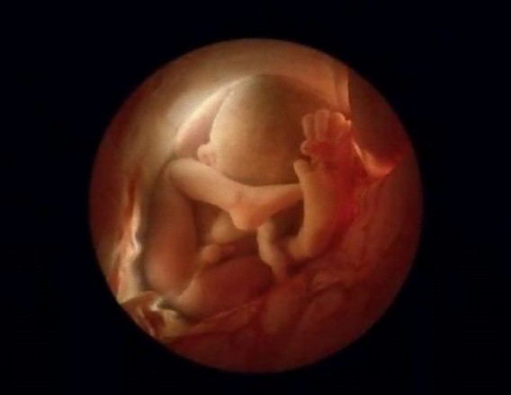 incredible_photos_a_child_is_born_640_26_e