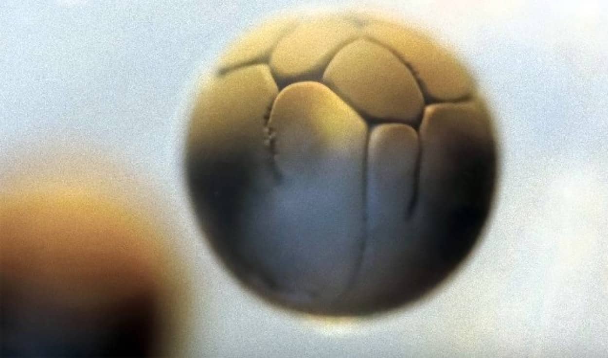 これはわかりやすい カエルの卵が細胞分裂を繰り返していく様子がわかるタイムラプス動画 カラパイア これはわかりやすい カエルの卵が細胞分裂を繰り返していく様子がわかるタイムラプス動画 カラパイア