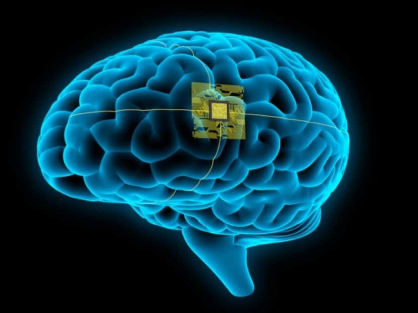 電脳化、脳インプラント