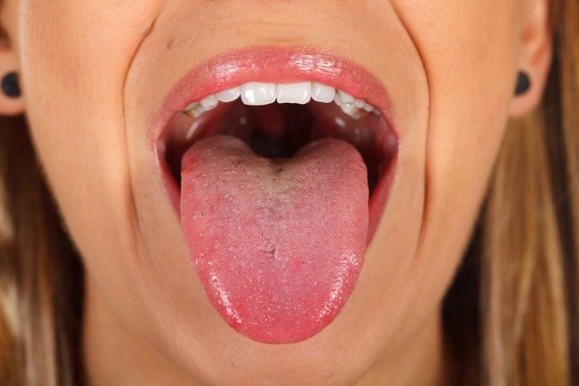新型コロナのあまり知られていない症状は舌や口の中に