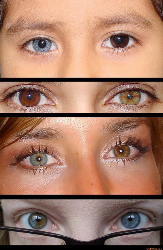 美しいオッドアイを持つ人々の画像 The Beauty Of Multi Colored Eyes カラパイア
