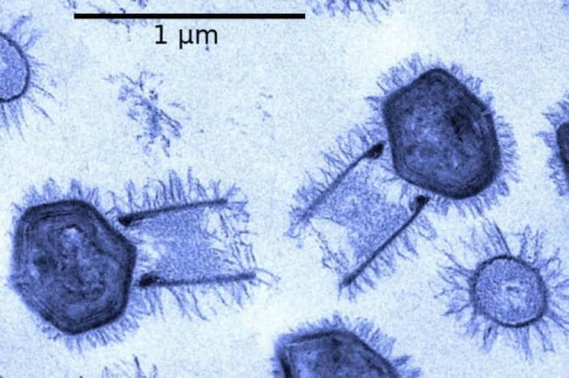 Tupanvirus_e