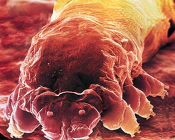 demodex-1