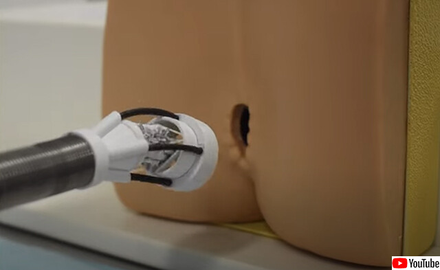 お尻の穴から挿入し、体中で傷を3Dプリンターで治療するロボットアームが開発される