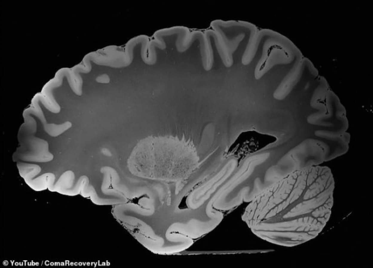 これまでで最も精細な人間の脳のスキャン映像 Mriで100時間かけて撮影 カラパイア