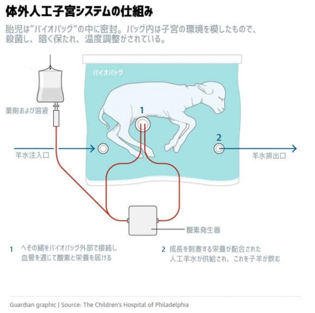 ビニール袋のような人工子宮の中で羊の胎児を育てることに成功 未熟児の命を救う 米研究 カラパイア