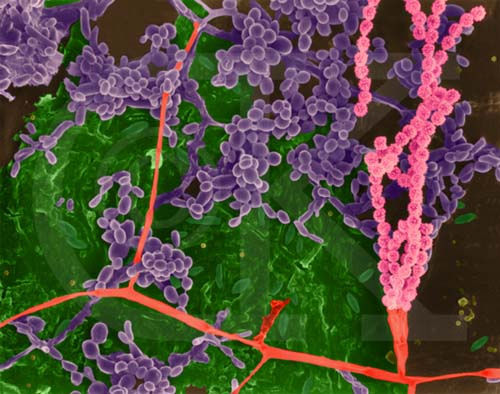 Bacteria and Fungi on a Kitchen Cutting Board (SEM x2,270)