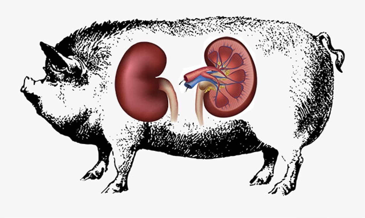 ブタの腎臓を人体に接続する実験に成功