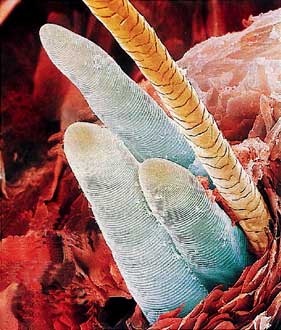 demodex-2