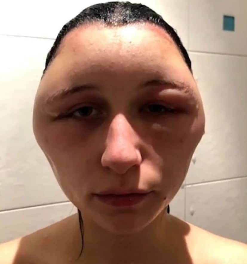12_e