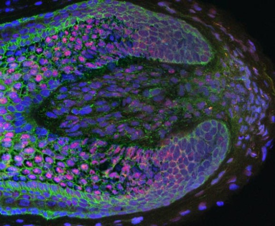 ハゲに悩む人に一縷の望み 毛乳頭細胞を培養して移植することで毛根を再生させることに成功 米英共同研究 カラパイア