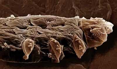 follicle%20mite1005