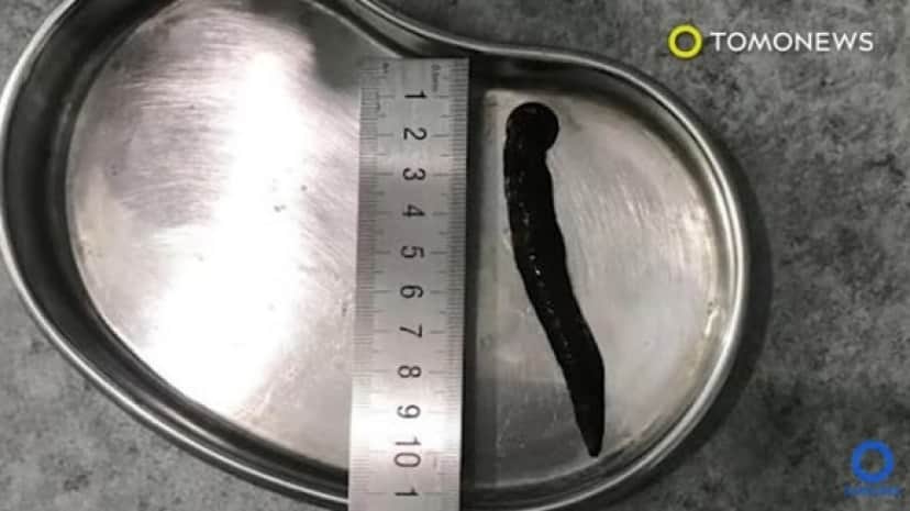 leech1_e