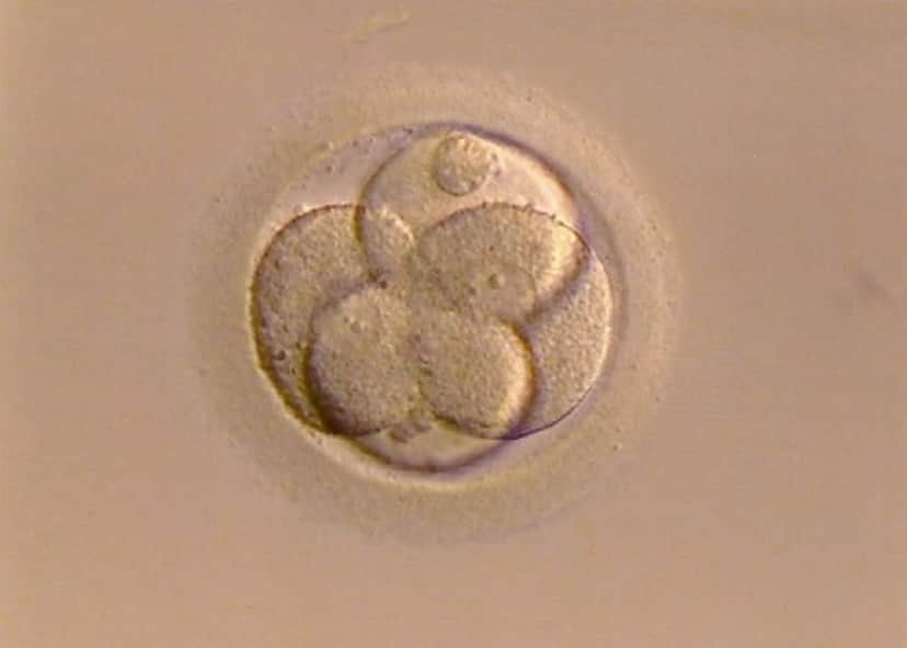fertilized-egg-267976_640_e