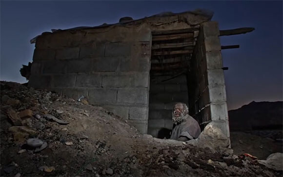 60年間まったく体を洗ったことのないウロコのような皮膚を持つイランの老人 カラパイア