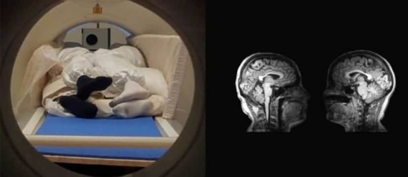 2人の脳をMRI