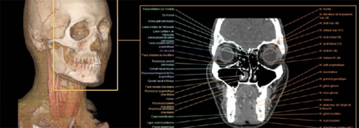 人体解剖学 体の部位ごとに見るｍｒiやｃｔを使った医療画像 インタラクティブ人体アトラス カラパイア