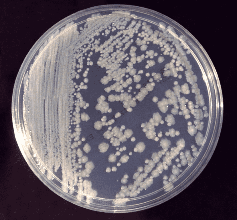 Enterobacter_cloacae_01_e