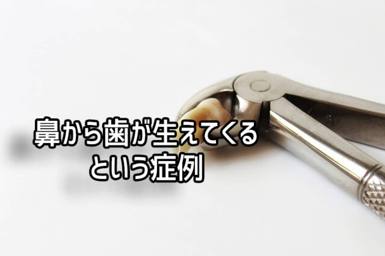 鼻の中の歯