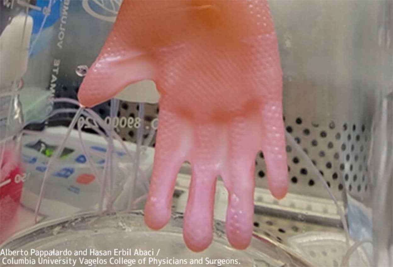 体にフィットする移植用の人工皮膚開発