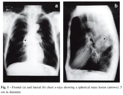 a14fig01