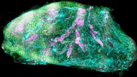 人間の内臓を完全に透明にすることに成功（ドイツ研究）