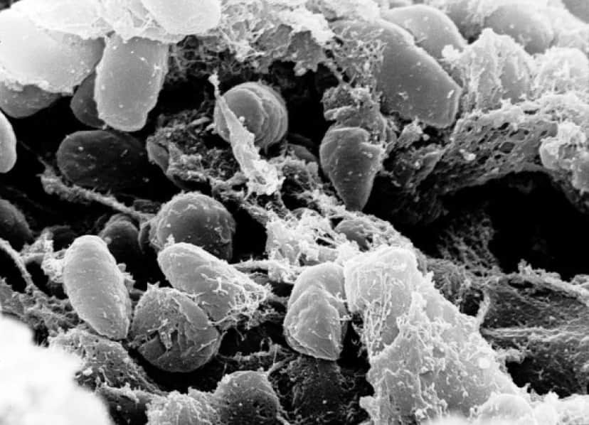 800px-Yersinia_pestis_e