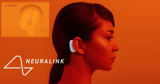 イーロン・マスクの電脳化計画、脳とコンピューターを結ぶ「Neuralink」の発表がこの後すぐ！