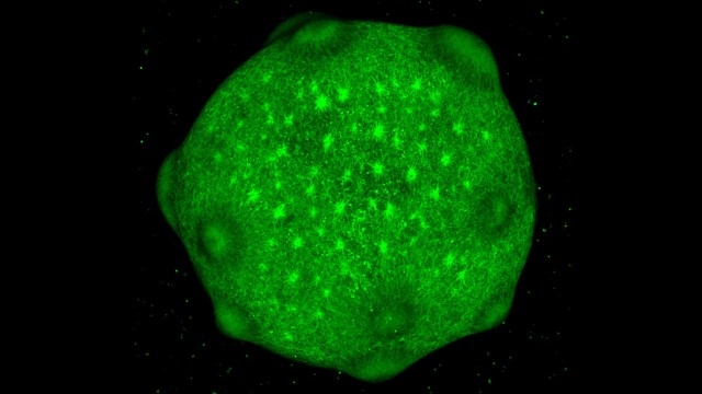 人工培養したミニ脳が乳児の脳に発達