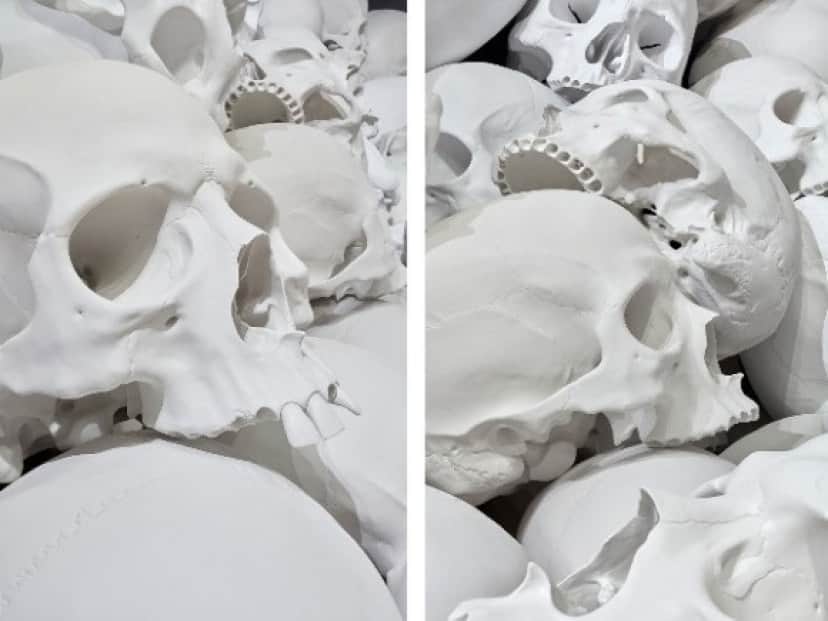 bone5_e