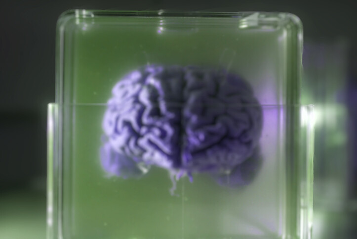 実験室で作られた人造のミニ脳が難病の治療に光明をもたらす